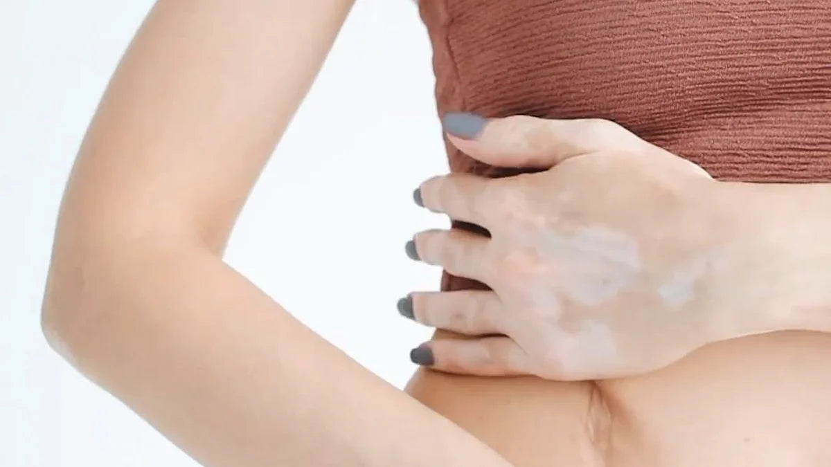 Effective Methods to Lower Melanin Levels in Your Skin