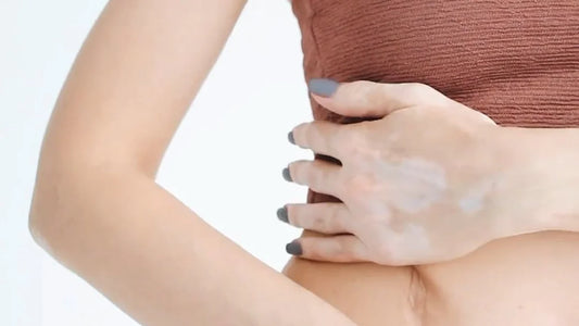 Effective Methods to Lower Melanin Levels in Your Skin
